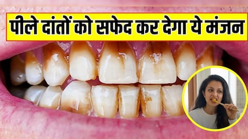 15 दिनों में सफेद हो जाएंगे पीले दांत, हेल्थ कोच ने बताया बस घर पर बनाकर लगा लें ये सस्ता पाउडर