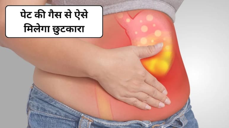 पेट की हवा कैसे निकाले? इन 3 तरीकों से पेट फूलना होगा बंद, आयुर्वेद डॉक्टर से जानिए कैसे
