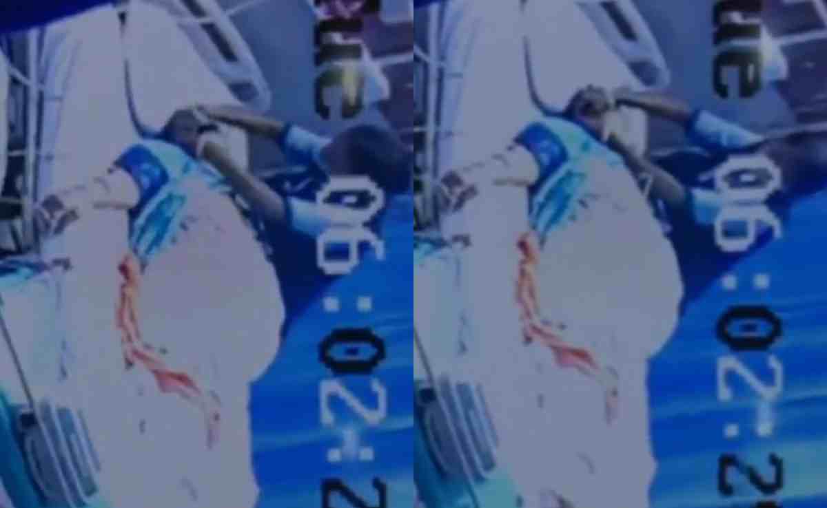 दिल्ली के अस्पताल में गहना चोरी का मामला : विवाद बढ़ने पर MS ने दी सफाई, जानिए क्या कहा?