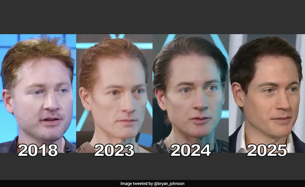 Bryan Johnson Claims He Hasn't Aged In A Year, Targets Immortality By 2039: "No To Death"