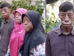 सुबह इंसान, शाम को बन जाते हैं छिपकली! डरता है पूरा गांव, फैमिली का रहस्य नहीं सुलझा पाए वैज्ञानिक