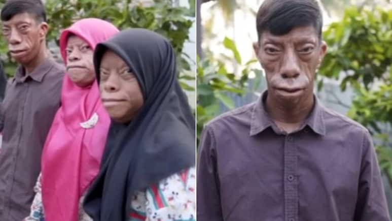 सुबह इंसान, शाम को बन जाते हैं छिपकली! डरता है पूरा गांव, फैमिली का रहस्य नहीं सुलझा पाए वैज्ञानिक