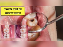 दांत खोखले और कमजोर हो रहे हैं? इन 3 तरीकों से मिलेगी राहत, मर जाएंगे दांतों के सारे कीटाणु और मसूड़े भी होंगे मजबूत