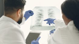 Cancer Surge In Tamil Nadu: Over 1 Lakh New Cases, Chennai Worst Hit