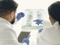 There's Now A Blood Test That Can Detect Lung Cancer In Real Time, Here's How