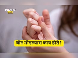 Knuckle Cracking: बोट मोडण्याची सवय आहे का? बोट मोडल्याने काय होतं? जाणून घ्या संशोधनातील माहिती