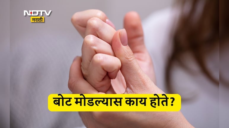 Knuckle Cracking: बोट मोडण्याची सवय आहे का? बोट मोडल्याने काय होतं? जाणून घ्या संशोधनातील माहिती