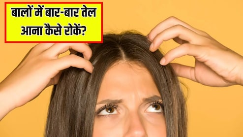बालों में बार-बार तेल आना कैसे रोकें? डर्मेटोलॉजिस्ट ने बताया क्या करने से चिपचिपे नहीं दिखेंगे बाल