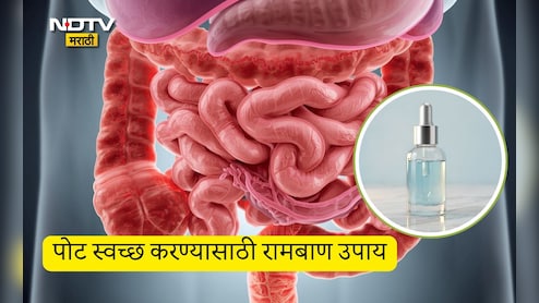 Stomach Cleaning Tips: गरम पाण्यात मिक्स करा ही 1 गोष्ट, आतड्यांमधील सर्व घाण एकाच दिवशी पटकन येईल बाहेर
