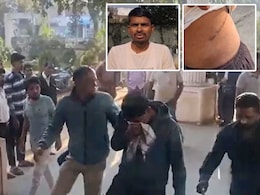 पहले खुद की बेची और फिर दूसरों की निकलवाने लगा, किडनी कांड वाले 'डॉक्टर' की पूरी इनसाइड स्टोरी