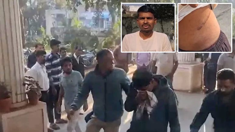 पहले खुद की बेची और फिर दूसरों की निकलवाने लगा, किडनी कांड वाले 'डॉक्टर' की पूरी इनसाइड स्टोरी