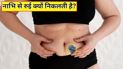 नाभि में से रुई क्यों निकलती है? जानें कैसे दूर होगी ये दिक्कत