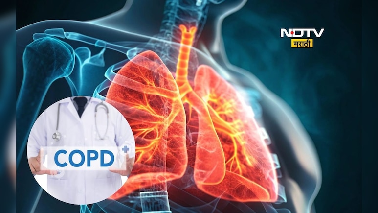 Health News: फुफ्फुसं ‘Silent Mode’ मध्ये जातात! COPD चे लपलेले ‘ते’ लक्षण समोर