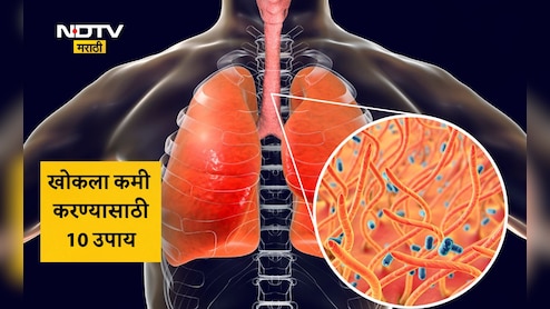Dry Cough Remedies: सिरप संपलंय? खोकलाही कमी होत नाही? तज्ज्ञांनी सांगितलेले 10 घरगुती उपाय वाचा