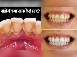 दांतों में जमा प्लाक कैसे हटाएं? डेंटिस्ट ने बताया पीली गंदगी साफ करने का सही तरीका