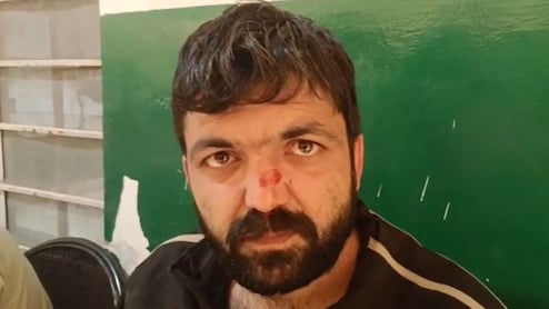 Rajasthan: बीजेपी के पूर्व मंत्री के बेटे ने यूथ कांग्रेस प्रदेश सचिव को पीटा, शराब के पैसे नहीं देने पर किया हमला