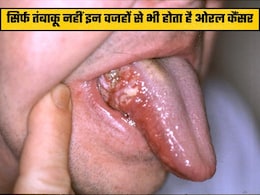 21 साल के युवक को बिना तंबाकू के हुआ कैंसर, डॉक्टर ने बताया चौंकाने वाला कारण