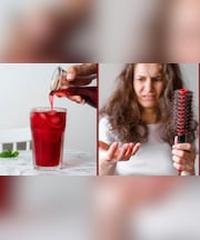 हेयरफॉल से हो गए हैं तंग? खाली पेट पीना शुरू कर दें ये ड्रिंक, योग गुरु ने बताया दूसरे दिन से ही मिलेगा रिजल्ट