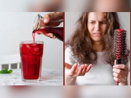 हेयरफॉल से हो गए हैं तंग? खाली पेट पीना शुरू कर दें ये ड्रिंक, योग गुरु ने बताया दूसरे दिन से ही मिलने लगेगा रिजल्ट