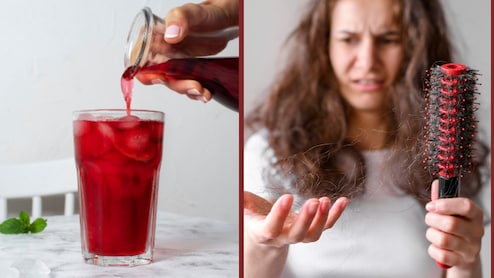 हेयरफॉल से हो गए हैं तंग? खाली पेट पीना शुरू कर दें ये ड्रिंक, योग गुरु ने बताया दूसरे दिन से ही मिलने लगेगा रिजल्ट