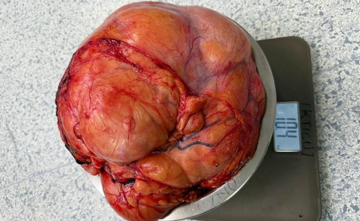 Latest and Breaking News on NDTV