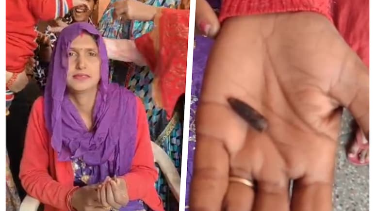 20 साल से जांघ में धंसी थी गोली, महिला को नहीं थी खबर... फरीदाबाद की 20 साल पुरानी ये कहानी हैरान कर देगी