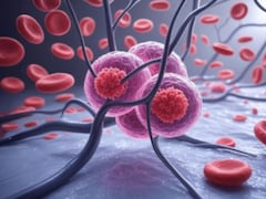 Teenager Diagnosed With Leukaemia After Doctors Dismissed Symptoms; Know The Signs, Types And Risks