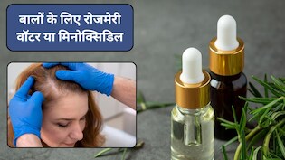 Rosemary Water vs Minoxidil: रोजमेरी वॉटर या मिनोक्सिडिल बालों के लिए कौन बेहतर, जानिए असल में बाल किससे उगते हैं?