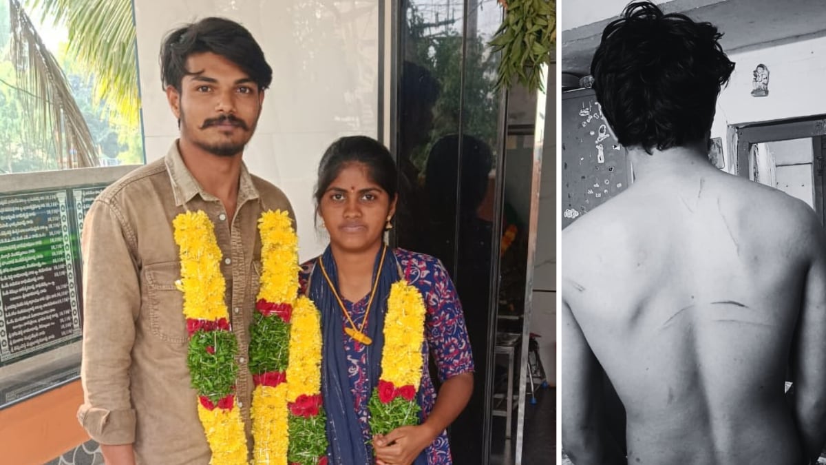 Tied To Pole, Dragged By Hair: Newlywed Man Assaulted By In-Laws In Andhra