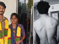 Tied To Pole, Dragged By Hair: Newlywed Man Assaulted By In-Laws In Andhra Pradesh