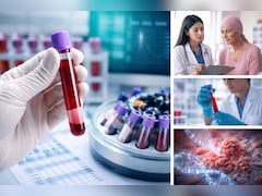 सिर्फ एक ब्लड टेस्ट बताएगा ब्रेस्ट कैंसर का कौन सा इलाज करेगा सबसे ज्यादा असर, नई स्टडी का दावा