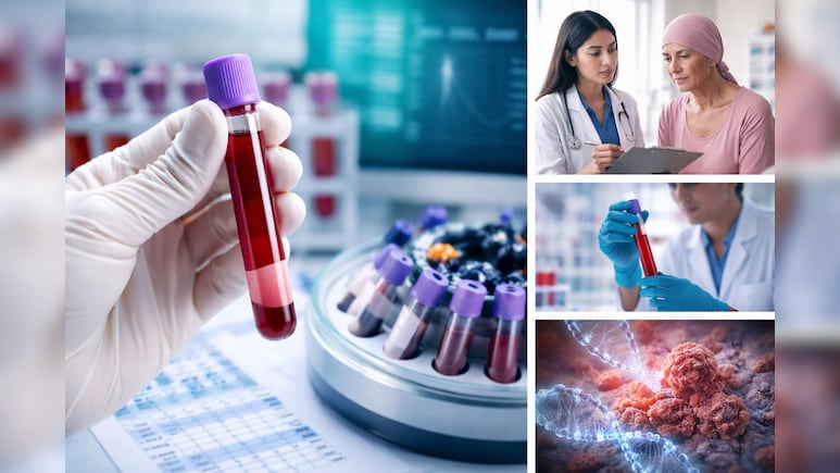सिर्फ एक ब्लड टेस्ट बताएगा ब्रेस्ट कैंसर का कौन सा इलाज करेगा सबसे ज्यादा असर, नई स्टडी का दावा