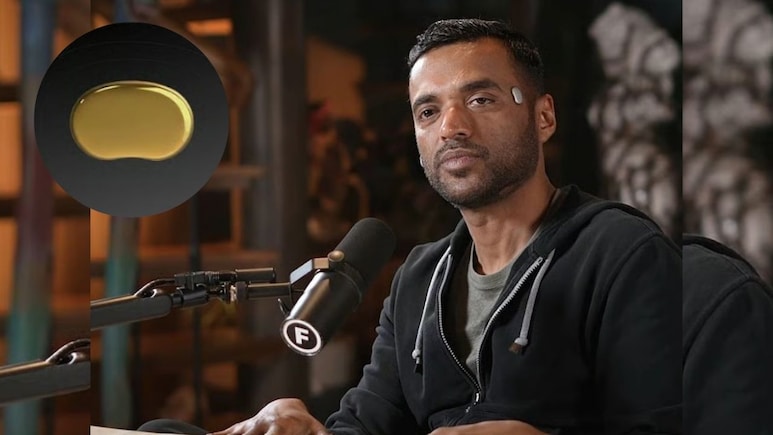 जोमैटो CEO दीपिंदर गोयल ने कनपटी पर लगाया था ये डिवाइस, अब AIIMS के डॉक्टर क्यों बोले इसे बकवास