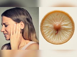 अब बिना सर्जरी ठीक होगा कान का पर्दा, रूस में सेल-बेस्ड तकनीक का क्लिनिकल ट्रायल शुरू