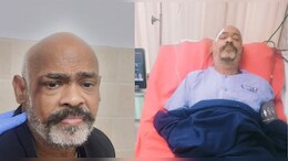 क्रिकेटर व&zwj;िनोद कांबली के स&zwj;िर से बह रहा खून, अस्&zwj;पताल से तस्&zwj;वीर आई सामने; ICU में भर्ती&nbsp;