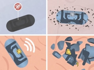 स्मार्ट गैजेट्स के बाद अब स्मार्ट दवा! चिप वाली गोली पेट में जाके भेजेगी सिग्नल, जानें किस काम आएगी