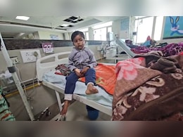 ग्वालियर में आवारा कुत्ते ने बच्चे को नोंचा, बड़ी मुश्किल से ऑपरेशन कर पाए डॉक्टर; चेहरे और पैरों में हुए घाव