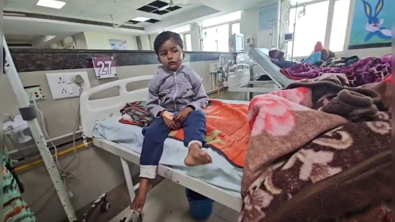 ग्वालियर में आवारा कुत्ते ने बच्चे को नोंचा, बड़ी मुश्किल से ऑपरेशन कर पाए डॉक्टर; चेहरे और पैरों में हुए घाव