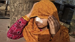 देवर ने भाभी की काटी नाक, देवरानी ने भी क&zwj;िया हमला&nbsp;