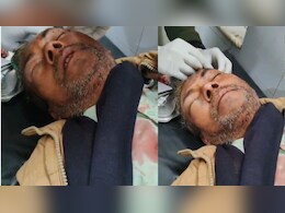 Satna News:  पहले बुजुर्ग की आंख में डाला मिर्ची पाउडर, फिर चाकू से कर दिया ताबड़तोड़ हमला