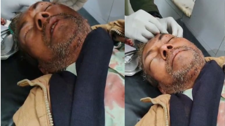 Satna News:  पहले बुजुर्ग की आंख में डाला मिर्ची पाउडर, फिर चाकू से कर दिया ताबड़तोड़ हमला