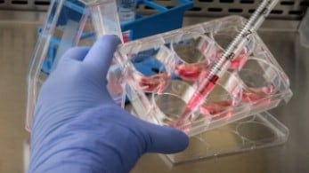 Dr. Reddy's Q4 Results Review - Ebitda Miss; Limited Visibility On U.S. Pipeline: Prabhudas Lilladher