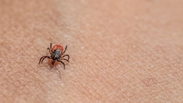 Hyderabad Study Traces Origins Of Mites And Ticks, May Help Track Future Disease Carriers