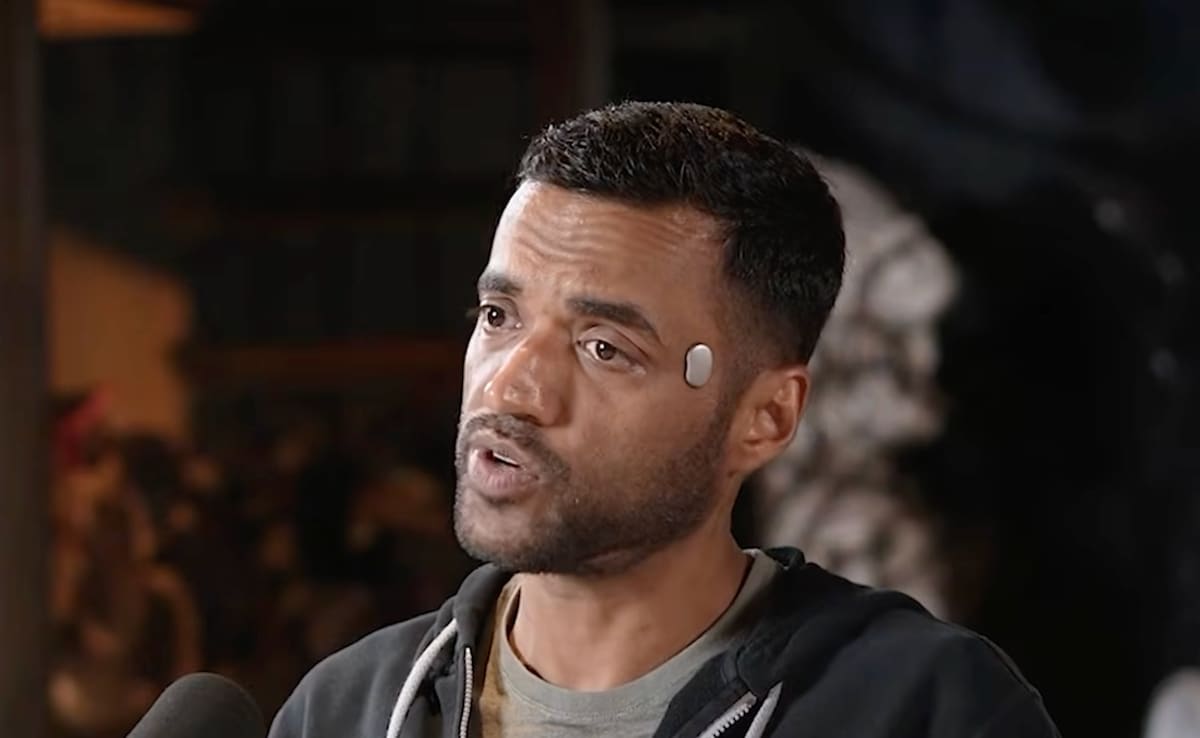 What Doctors Really Think About Zomato Founder Deepinder Goyal's Temple Device