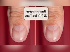 नाखूनों पर हल्की काली लाइनें क्यों होती हैं? नाखूनों पर काली लकीर का क्या मतलब है, एक्सपर्ट से जानिए
