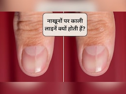 नाखूनों पर हल्की काली लाइनें क्यों होती हैं? नाखूनों पर काली लकीर का क्या मतलब है, एक्सपर्ट से जानिए