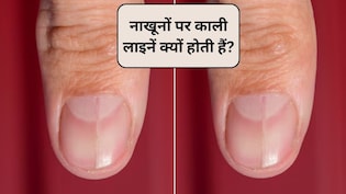नाखूनों पर हल्की काली लाइनें क्यों होती हैं? नाखूनों पर काली लकीर का क्या मतलब है, एक्सपर्ट से जानिए