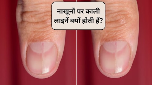 नाखूनों पर हल्की काली लाइनें क्यों होती हैं? नाखूनों पर काली लकीर का क्या मतलब है, एक्सपर्ट से जानिए