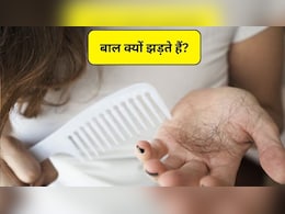 25 के बाद बाल झड़ने की असल वजह क्या है? यहां जानिए 3 कारण और बचाव