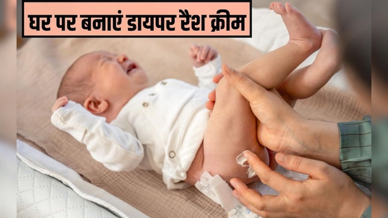 डायपर से बच्&zwj;चे को हो गए हैं रैशेज, इन 2 चीजों से घर पर बनाएं रैशेज क्रीम, बेबी को म&zwj;िलेगा तुरंत आराम